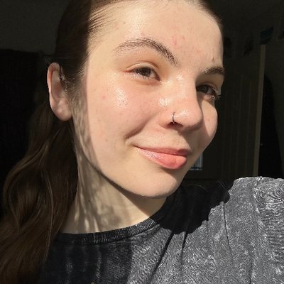 Maya, Laser Technician at Peach Lasers Marda Loop